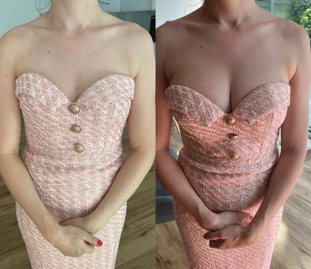 ZEYA - Wilma Double - Sided Adhesive Breast Patches